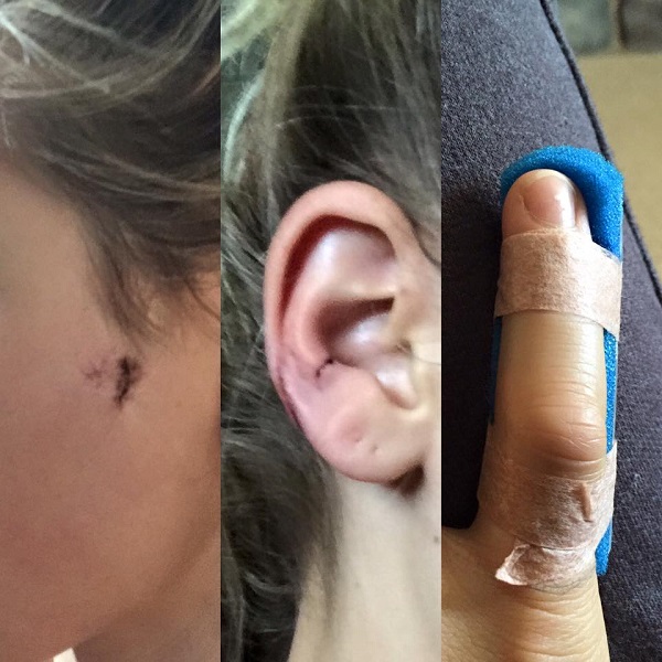 A street fight Saturday resulted in minor injuries to a Paso Robles woman.