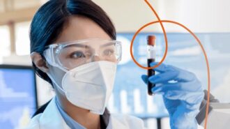 covid antibody testing