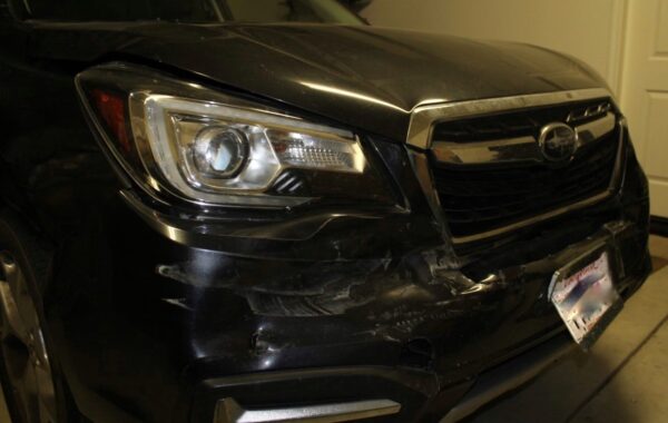 dented car