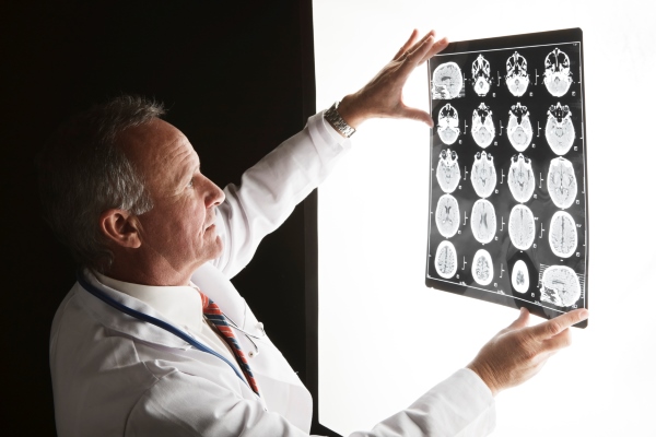 Alzheimer’s Association hosting free research reception in Templeton