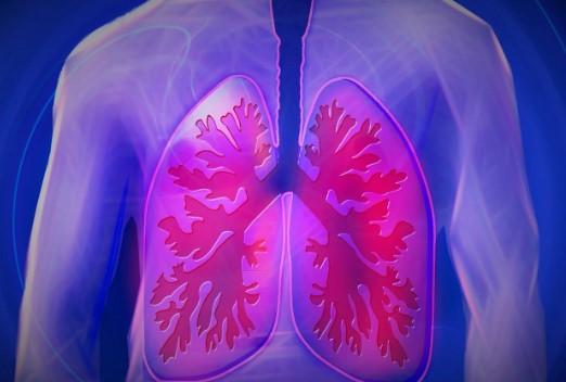 Tuberculosis cases rising in county, state