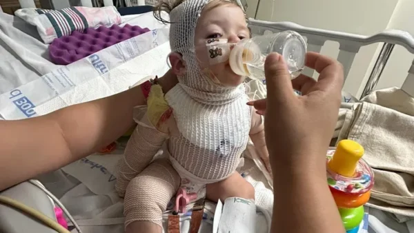 Family seeks help after baby burned by fireworks in Paso Robles