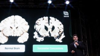 Cal Poly graduate works to commercialize concussion detection device