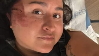 Community raises funds for local barber injured in cliff fall